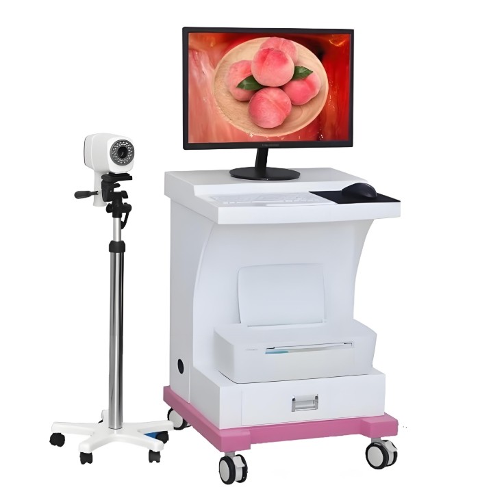 國產內窺鏡 國產內窺鏡